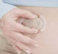 CeQur Simplicity Wearable Insulin  2U 8 Pack (Special order 5-8 days)